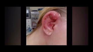 Infected Industrial Piercing 2008 [upl. by Doll408]