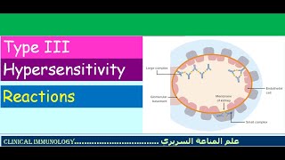 Lecture 6  Type III Hypersensitivity [upl. by Carlos]