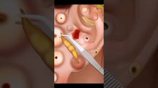 Asmr ear cleaning video  asmr ear cleaning video [upl. by Grossman]