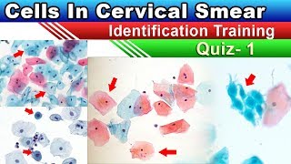 Cervical Smear Cells Identification Training Quiz 12 [upl. by Morton]