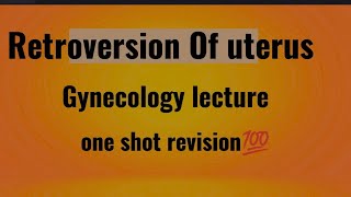 RETROVERSION OF UTERUS  Gynecology lecture [upl. by Lindeberg]