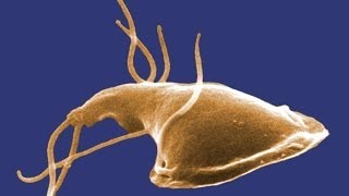 Giardia What You Should Know [upl. by Fulks]