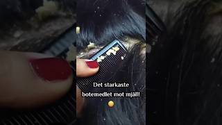 Det starkaste botemedlet mot mjäll 😳 MORINZ bioderma men women MÖRINZ beautybysweden fyp [upl. by Ahsoet]