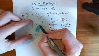 Cardiac Hypertrophy and the Sarcoplasmic Reticulum Part 1 [upl. by Ahkihs152]