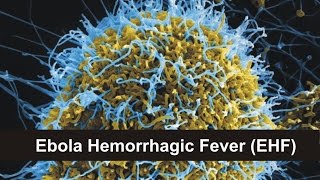 Ebola Hemorrhagic Fever EHF [upl. by Suiram]