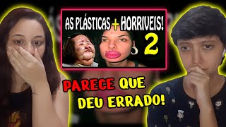 React Plásticas Terríveis 2 As Plásticas que deram Totalmente Errado PARTE 2  Fala de Tudo [upl. by Lain]