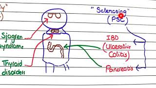 Primary Biliary Cholangitis and Primary Sclerosing Cholangitis  Pathology [upl. by Lisabet]