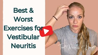 Best and Worst Vertigo Exercises for Vestibular Neuritis [upl. by Ntsud]