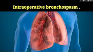 intraoperative bronchospasm [upl. by Storm918]