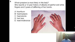 Part 2 Practice questions for Rheumatology Dr Kenny Sunmboye [upl. by Aynotahs63]