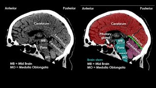 CT Head Anatomy  CT Head Interpretation  CT Head Anatomy Radiology ctheadanatomy anatomy [upl. by Anairol]