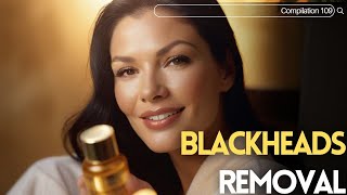 Skincare  Blackheads Removal 109 skincare skincare blackheads blackheads [upl. by Erroll822]