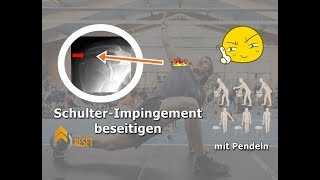 SchulterImpingement beseitigen  DIE Übung für schnelle Fortschritte [upl. by Acino]