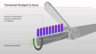 Lotus  Torsional Vibration [upl. by Dnana]