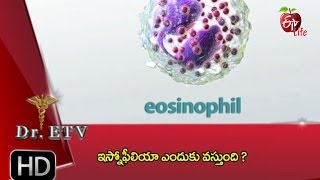 Dr ETV  Eosinophilia allergy  24th January 2017  డాక్టర్ ఈటివీ [upl. by Estrellita]