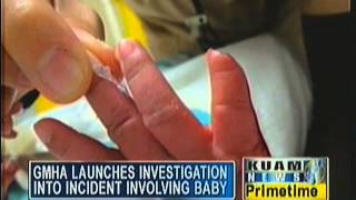 Baby loses part of finger in hospital incident [upl. by Fredkin]