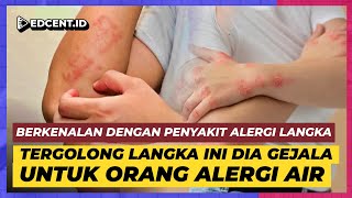 Alergi Air Alergi Langka [upl. by Nyrahtak]