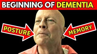 7 EARLY SIGNS OF DEMENTIA YOU SHOULD NEVER IGNORE SILENT SYMPTOMS OF ALZHEIMERS [upl. by Ahsier]