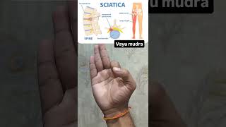 Learning Vayu Mudra beneficial in sciatica pain [upl. by Ekyt263]