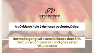 Retração Gengival e Sensibilidade Dentária dentista implantedentário proteseprotocolo [upl. by Brott]