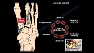 Lisfranc Injuries  Everything You Need To Know  Dr Nabil Ebraheim [upl. by Aretina]