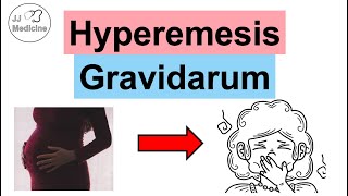 Hyperemesis Gravidarum Pregnancy Nausea Risks Symptoms Complications Diagnosis Treatment [upl. by Best458]