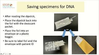 Instruction for using the dipstick test to detect V Cholerae English [upl. by Bryanty134]