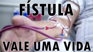 FÍSTULA para Hemodiálise Como e Quando deve ser Feita [upl. by Dympha]