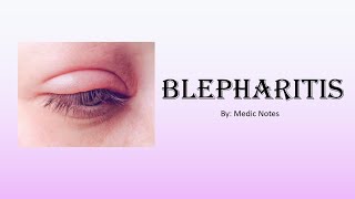 Anterior and posterior blepharitis  clinical features treatment [upl. by Schubert]