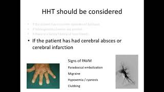 Hereditary Haemorrhagic Telangiectasia HHT for ENT doctors by Prof Anette Kjeldsen [upl. by Lunetta126]