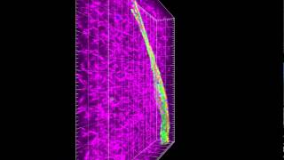 Phenotype of a control cell plated in 3D collagen matrix [upl. by Amabil]