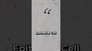 Epithelial cells in Urine under Microscope [upl. by Bainbrudge]