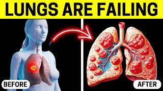 7 Signs Youve Had a Lung Infection Without Knowing [upl. by Ricketts]