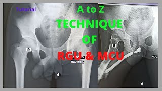 Technique of RGU amp MCU Ep31 Retrograde rethrogram and Micturating cystogram  Bangla Tutorial [upl. by Anelahs]