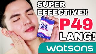 DermAid ACNE SOAP sa WATSONS Super Effective for PIMPLES [upl. by Jorgan]