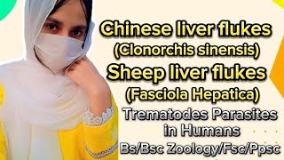 Chinese Liver Flukes  Sheep Liver Flukes  Fasciola Hepatica Trematodes parasites in Humans  ppsc [upl. by Bertsche]