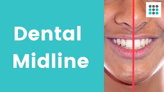 DENTAL MIDLINE SHIFT What why and how to correct l Dr Melissa Bailey [upl. by Adnawaj]