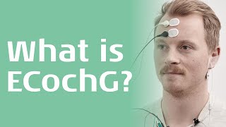 What is the Electrocochleography ECochG Test [upl. by Enaud]