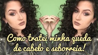 Como tratei minha queda de cabelo e seborreia [upl. by Aleafar]