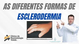 As diferentes formas de ESCLERODERMIA [upl. by Meriel131]