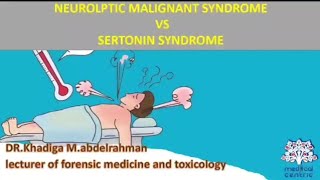 Neuroleptic malignant syndrome vs Sertonin syndrome Hyperthermia [upl. by Evalyn]