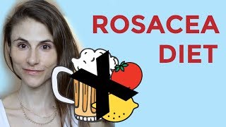 ROSACEA DIET FOODS SUPPLEMENTS PROBIOTICS DR DRAY [upl. by Peednam]