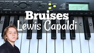 Bruises  Lewis Capaldi  Easy Keyboard Tutorial With Notes [upl. by Virgy]