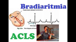 Belajar ACLS Bradiaritmia Sinus Bradikardi AV block Mobitz 1 Mobitz 2 UKDI UKMPPD [upl. by Dorisa]