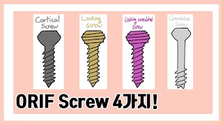 수술용 Screw 40초 안에 구분하기 cortical screw locking screw locking cannulated screw cannulated screw [upl. by Fortunato]