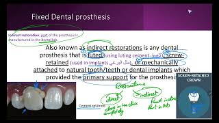 Introduction to Fixed Prosthodontics [upl. by Julina]