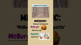 How to Perform McBurneys Test for Appendicitis  alluringlearner shorts mbbs quickrevision [upl. by Rodd]