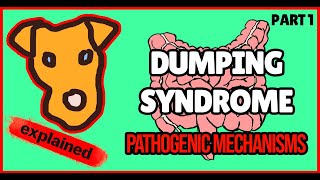 Dumping syndrome Part 1 Definition Physiology General concepts [upl. by Blatt632]