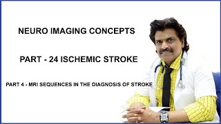 NEURO IMAGING CONCEPTS PART 24 ISCHEMIC STROKE  PART 4 [upl. by Konstantin840]