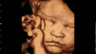 3D ultrasound at 31 weeks GoldenView Ultrasound [upl. by Enileve]